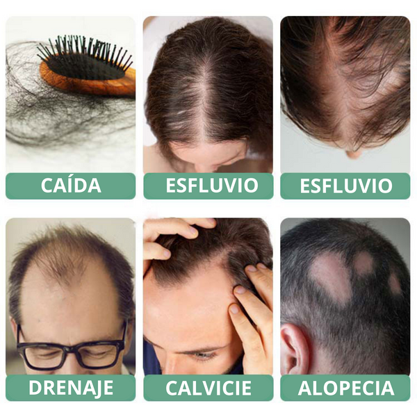 Repair Hair® Reduce la caída del cabello en un 95% y acelera el crecimiento 10 veces ( PAGUE 1 RECIBA 2 )