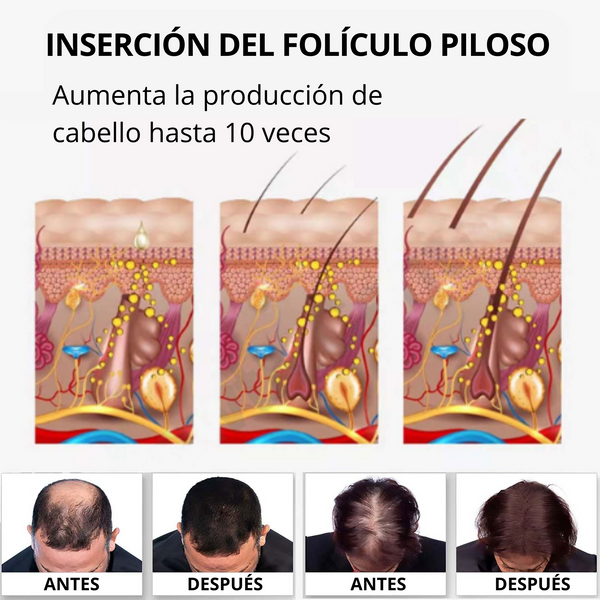 Repair Hair® Reduce la caída del cabello en un 95% y acelera el crecimiento 10 veces ( PAGUE 1 RECIBA 2 )